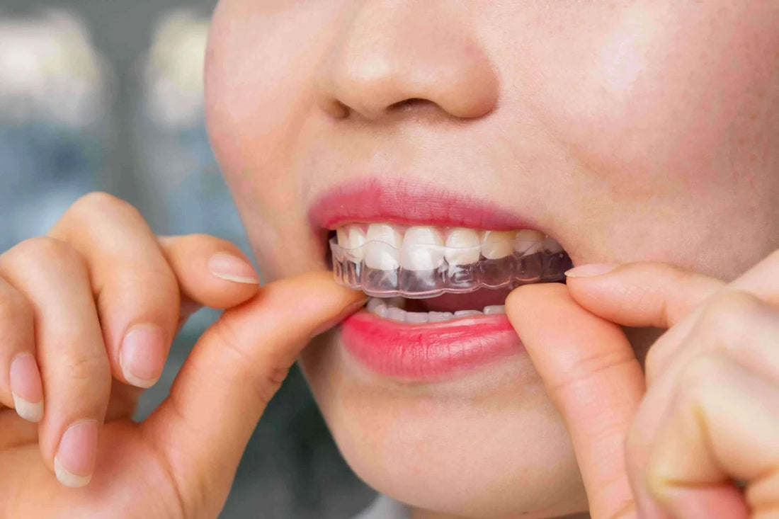 Surprisingly, a free and online way to have your teeth aligned.