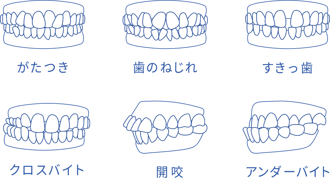 全額矯正も可能なので、ほぼ全ての症例に対応